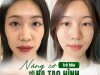 NÂNG CƠ TRẺ HOÁ VỚI HA TẠO HÌNH