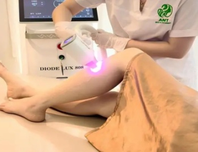 Khám Phá Top 5 Spa Triệt Lông Uy Tín Vũng Tàu